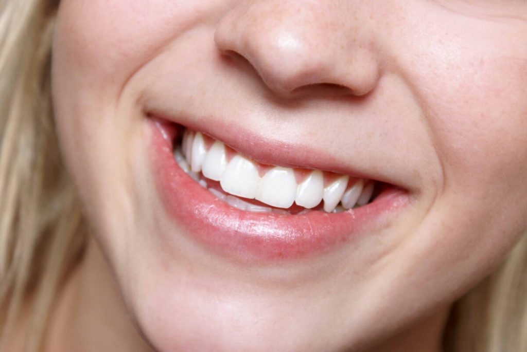 Фото передних зубов для женщин